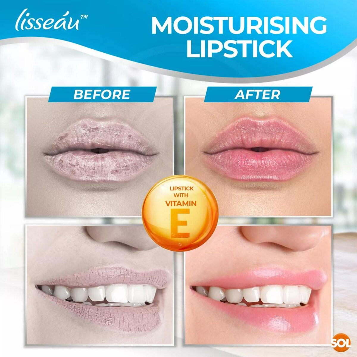 14X Lip Balm Set Mul 1f9f2d7be49323204380d1fa1915bbf7